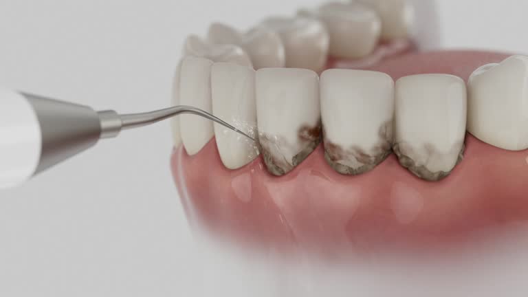 Trusted Root Canal Treatment service in Foresthill, CA - Dentist Open Now